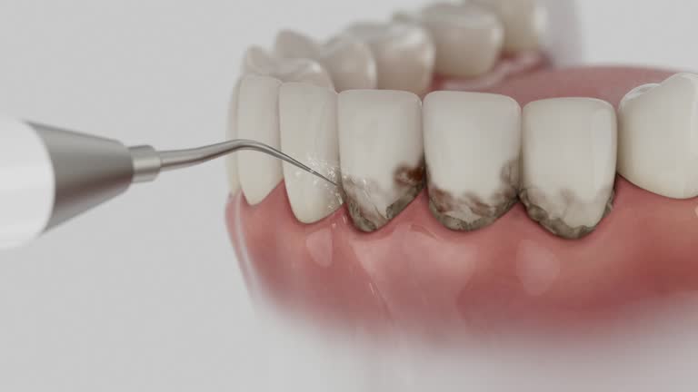 Trusted Dental Implants service in Burlington, IA - Dentist Open Now